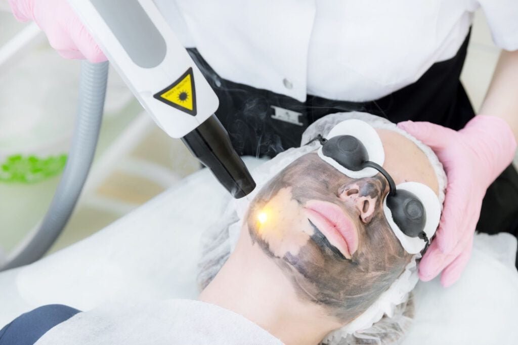 Laser Carbon Facial Bundle