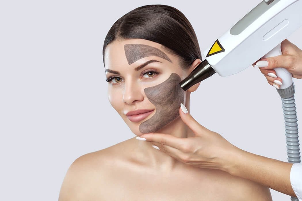 Laser Carbon Facial Bundle