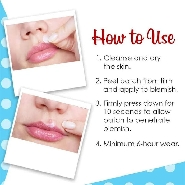 Bye Bye Blemish Microneedling Blemish Patches