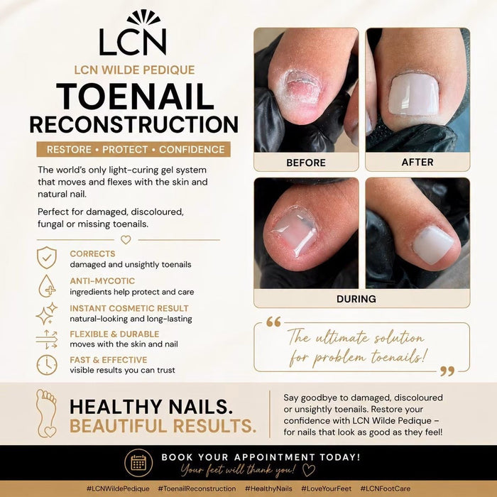 LCN Ingrown Toenail Brace B/S Bracing System, Size 18 Canada