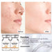 PDRN Salmon DNA Serum Ampoule Set