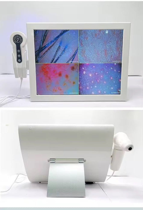 Professional Digital Hair / Scalp Analyzer Hair Follicle Camera, 15 inch Display