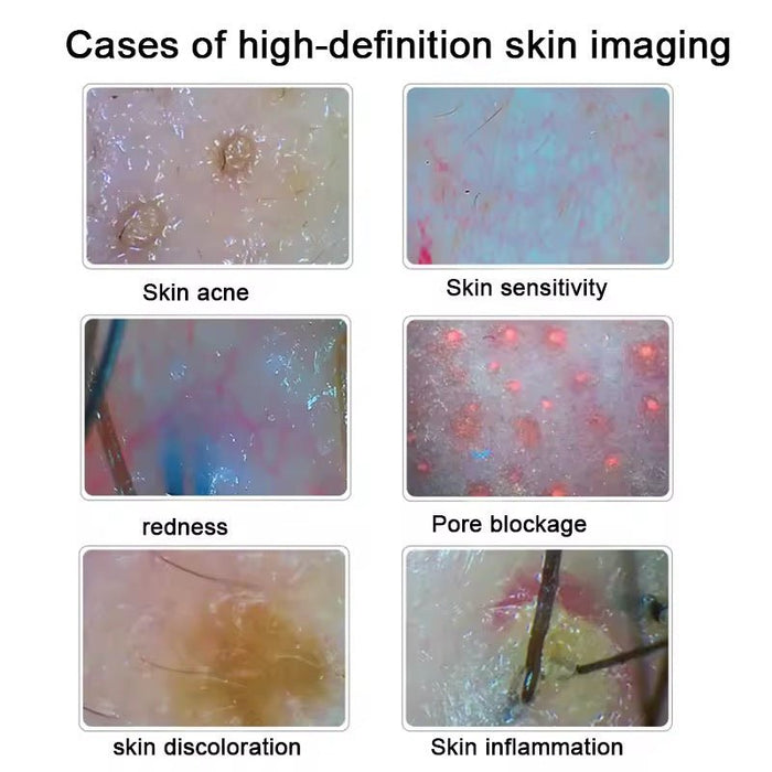 Professional Digital Hair / Scalp Analyzer Hair Follicle Camera, 15 inch Display