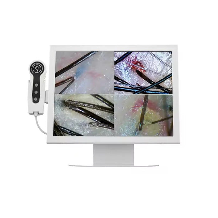 Professional Digital Hair / Scalp Analyzer Hair Follicle Camera, 15 inch Display
