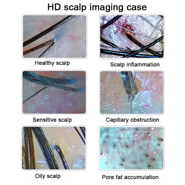Professional Digital Hair / Scalp Analyzer Hair Follicle Camera, 15 inch Display