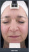 Silhouet Tone RMD Structural Remodelling Unit - Skin Tightening and Lifting Effect for Face + Neck