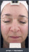 Silhouet Tone RMD Structural Remodelling Unit - Skin Tightening and Lifting Effect for Face + Neck
