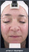 Silhouet Tone RMD Structural Remodelling Unit - Skin Tightening and Lifting Effect for Face + Neck
