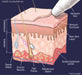 Silhouet Tone Vortex Peel 110V Microdermabrasion Machine