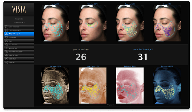 Visia Skin Analysis System Generation 7, Pre - Owned / Used