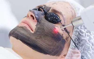 Carbon Gel Facial Mask for Carbon Laser, 80 ml
