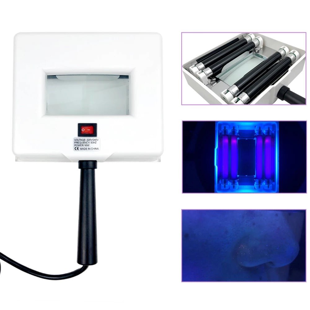 Portable Skin Analyzer Woods Lamp - Beauty Pro Supplies Canada