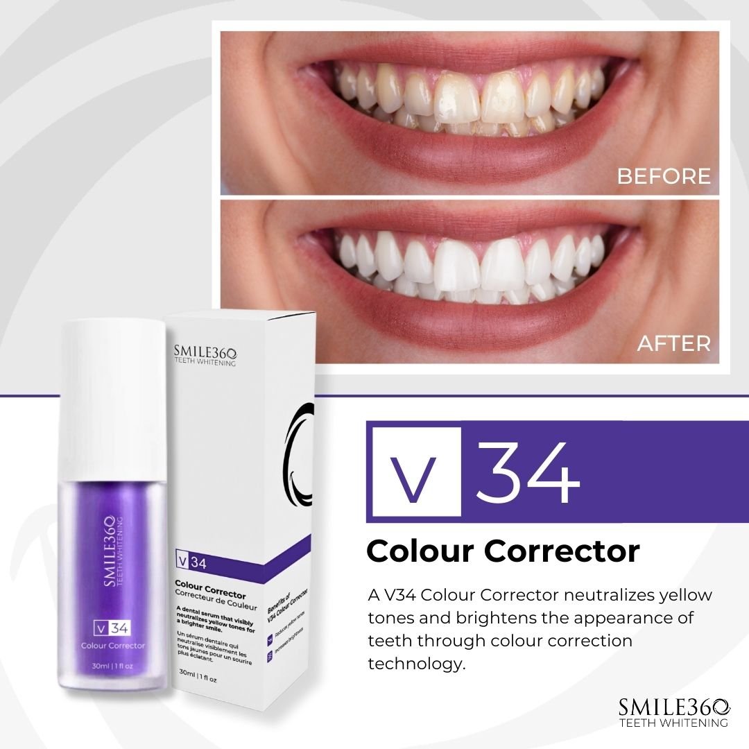Smile360 v34 Colour Corrector Teeth Whitening Serum - Beauty Pro Supplies Canada